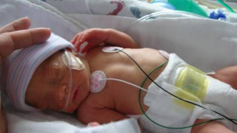 Новородено на три дни умря от кръвоизлив в мозъка