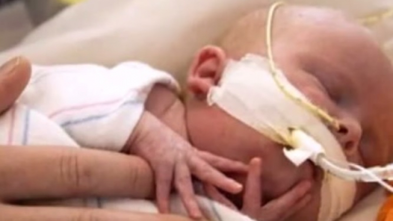 2-месечно бебе е най-младия пациент в света с присадено сърце (ВИДЕО)