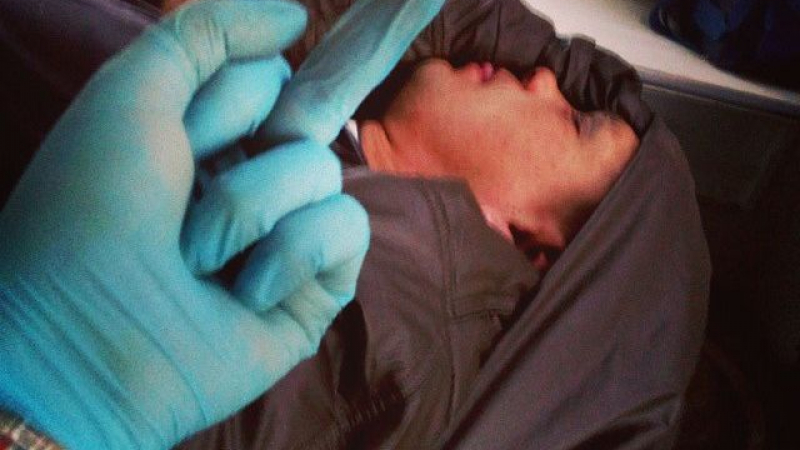 Фелдшерка пусна селфи със среден пръст пред пациент 