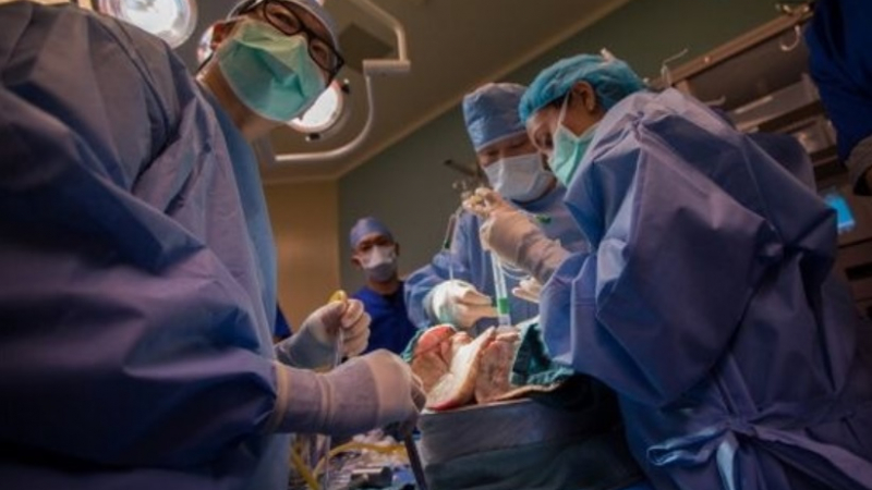 45 лекари направиха трансплантация на лице