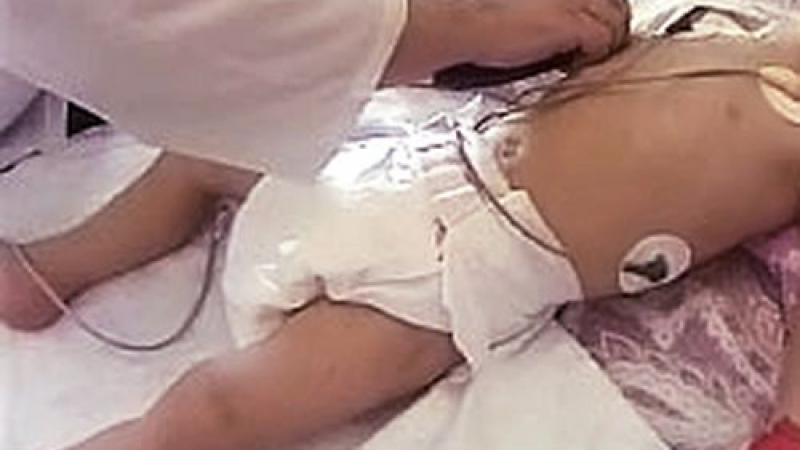 Дете на 2 години бере душа със счупени ребра и повреден далак
