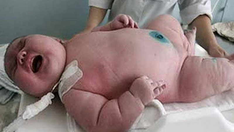 Рекорд за Гинес: 200-килограмова майка роди гигантско бебе - 18 кила