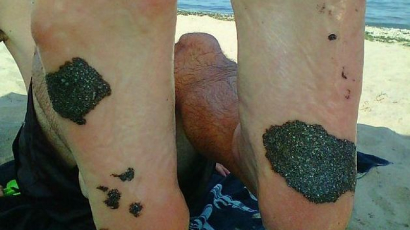 Нещо става на плажа в Аркутино - мазни черни парчета лепнат по краката на туристи