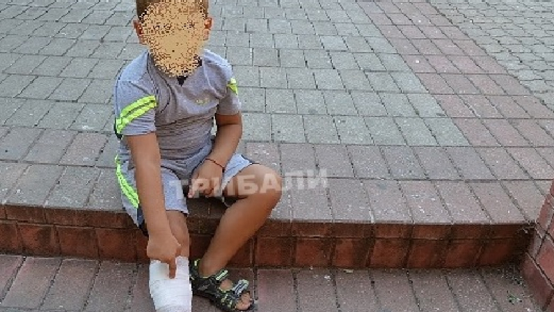 Помияри нахапаха дете в центъра на Враца, то крещи от болка и уплаха (СНИМКИ)