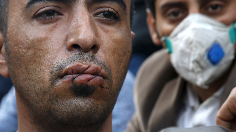 Потресаващо! Бежанци си зашиха устата публично (СНИМКИ 18+)