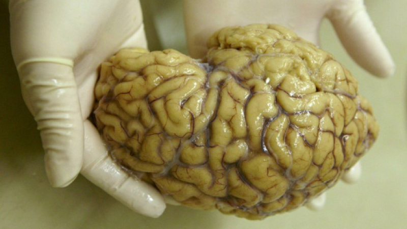 Сензация! Учени откриха как да съживяват хора след замразяване на мозъка