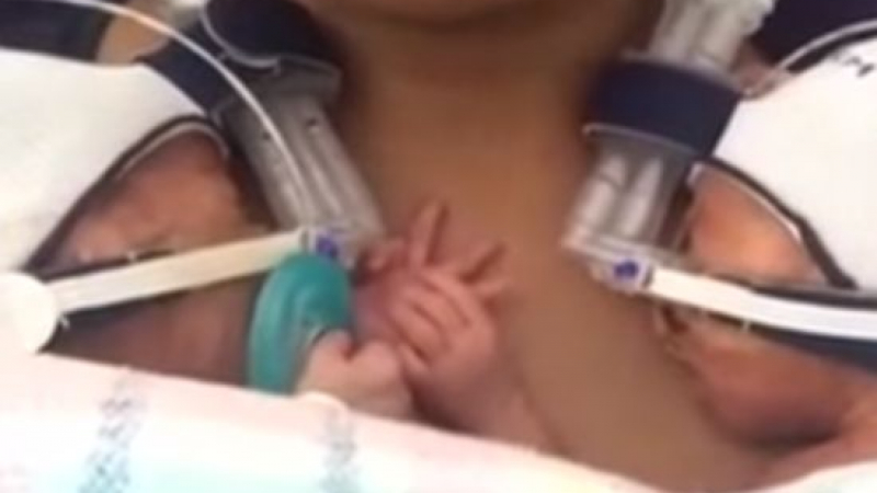Трогателен клип с недоносени близнаци разнежи потребителите в мрежата (ВИДЕО)


