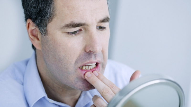 5 причини да се тревожите заради кръв от венците 