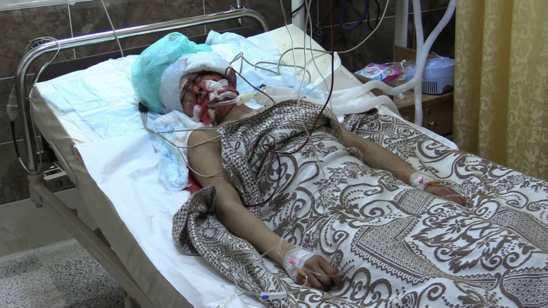 Кървава нощ в Африн: Болниците са претъпкани от убити и ранени жени и деца след турския обстрел (СНИМКИ/ВИДЕО 18+)