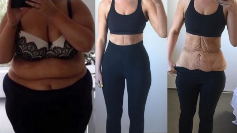 Неузнаваема: 25-годишна отслабна със 100 кила пред очите на фенове от Instagram
