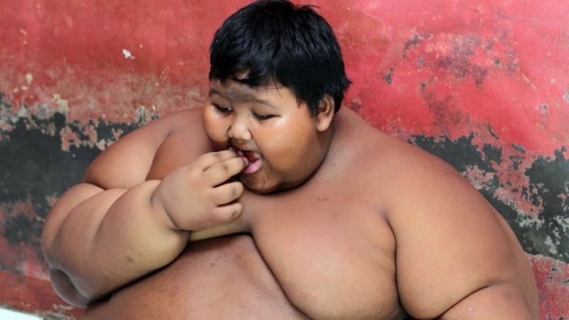 Най-дебелото дете е от Индонезия и тежи 190 кг.! (ВИДЕО)