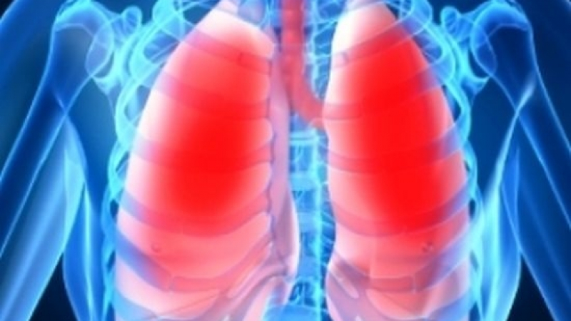 Мор от туберкулоза в Бургас, 50 души заразени за шест месеца