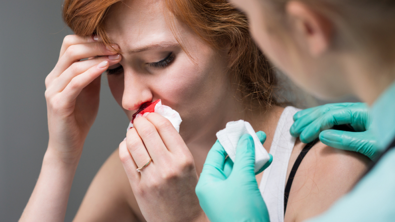Опасно ли е кървенето от носа 