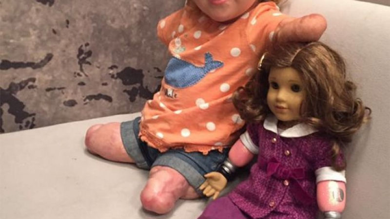 Трогателно! Кукла с ампутирани крайници за момиченце без ръце и крака (СНИМКИ)