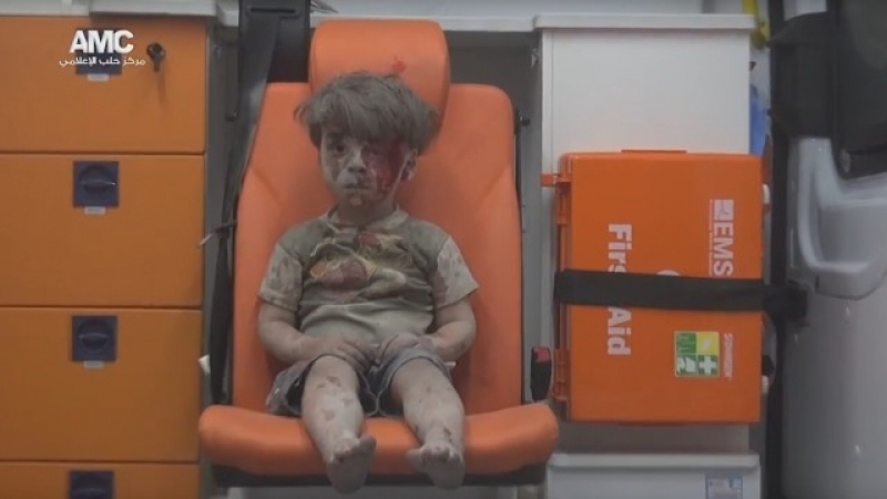 Спасителят на малкия Омран: Той не е единствената жертва на бомбите