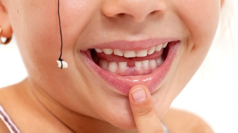 Лекарите съветват да се пазят млечните зъби на децата. Ето защо…