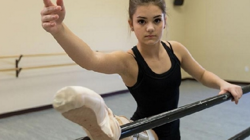Това героично 15-годишно момиче загуби крак заради рак, но стана чудесна балерина (СНИМКИ/ВИДЕО)
