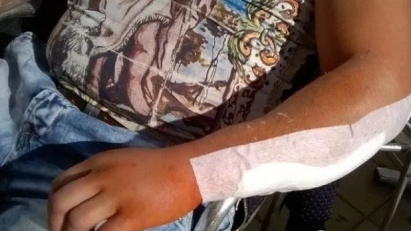 Раненият Димитър след кървавото меле в Сунгурларе: Десетки диваци от гетото дойдоха да ни трепят. Страшно е!