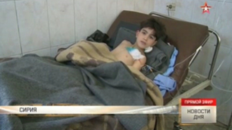 Кошмарът в Алепо! Пострадало детенце разкри: Снаряд избухна в краката ми! Костта ми се отдели (ВИДЕО 18+)