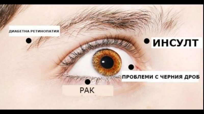 8 сигнала, с които очите ви алармират, че имате сериозни здравословни проблеми!