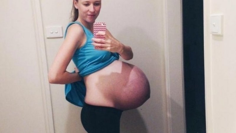 Бременна публикува тази своя снимка във Фейсбук и я сполетя голяма беда
