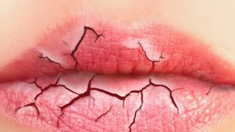 4 съвета как да се справим с напуканите устни