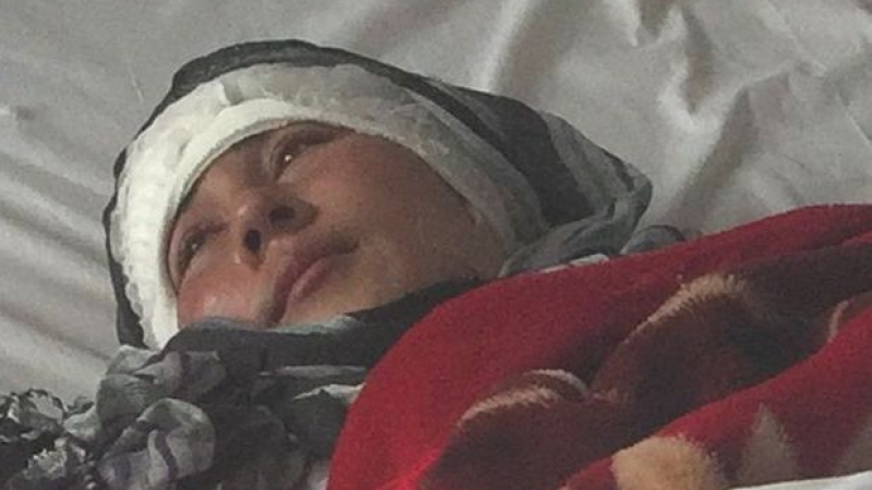 Шок и ужас! Афганистанец отряза двете уши на младата си жена за няма нищо 