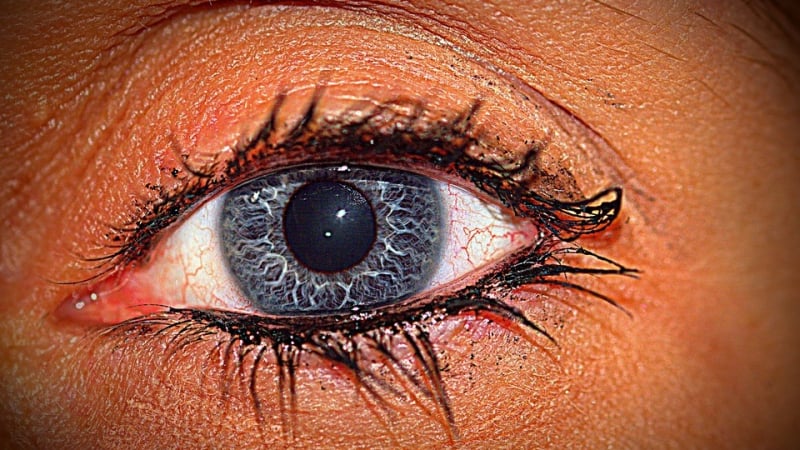 Трептенето на окото вещае опасни заболявания
