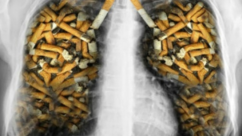 Три домашни рецепти изчистват белите дробове от натрупаните катрани от пушенето