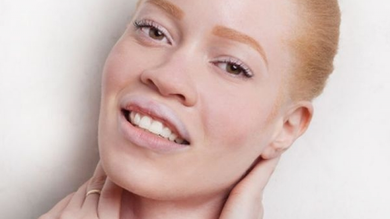Тази красива моделка албинос изуми света с външния си вид! (СНИМКИ)