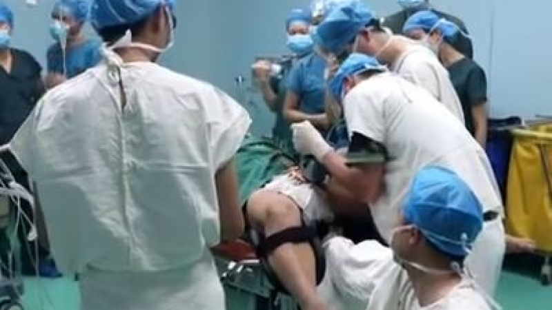 Уникална операция: Лекари отстраниха лагер от пениса на китаец (ВИДЕО)