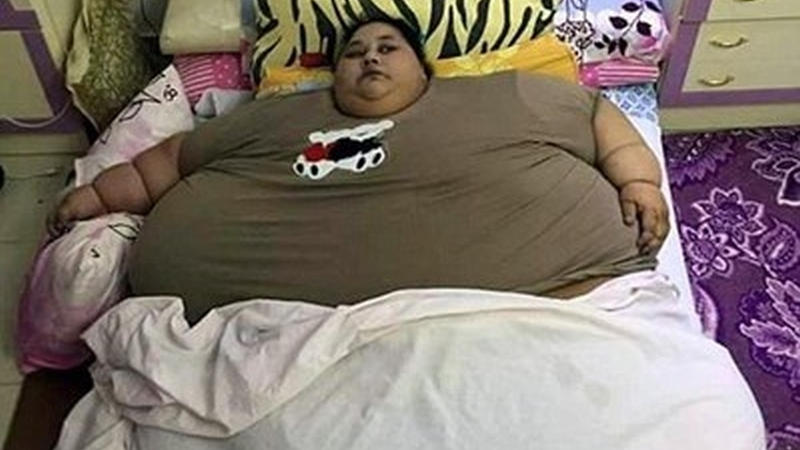 Най-дебелата жена на света отслабна с 242 килограма