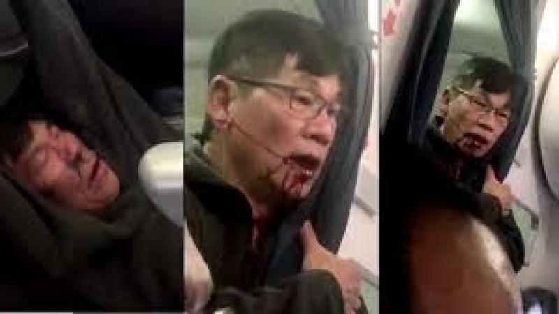 Жестоко влаченият пътник на United Airlines сравни инцидента с бойното поле във Виетнам
