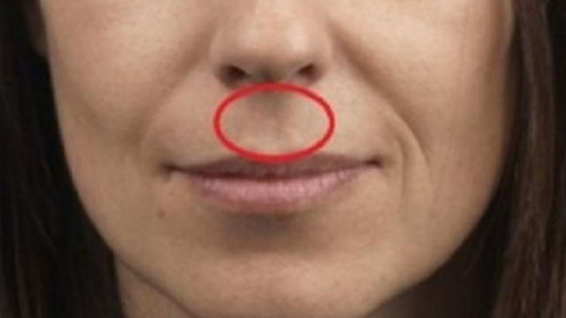 Имате ли това между носа и горната устна? А знаете ли какво означава това? Вижте тук! (СНИМКА)