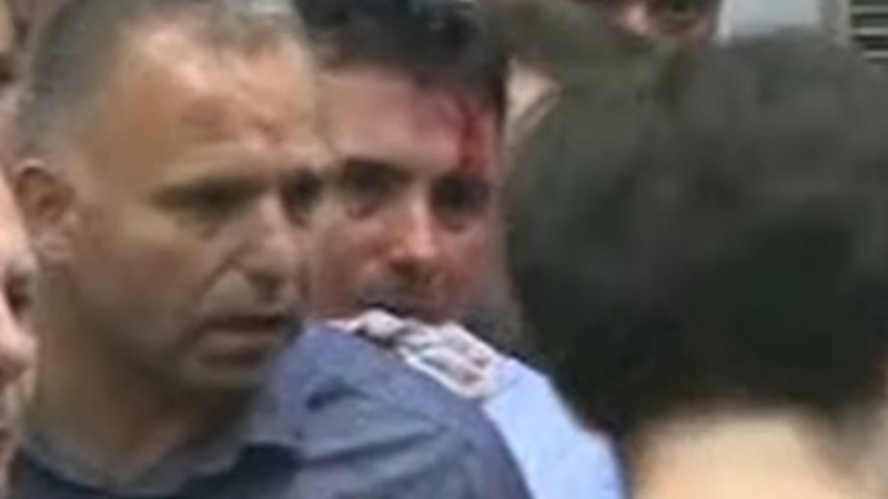 В Македония напрежението ескалира: Окървавеният Зоран Заев изригна мощно: Това бе опит за убийство!