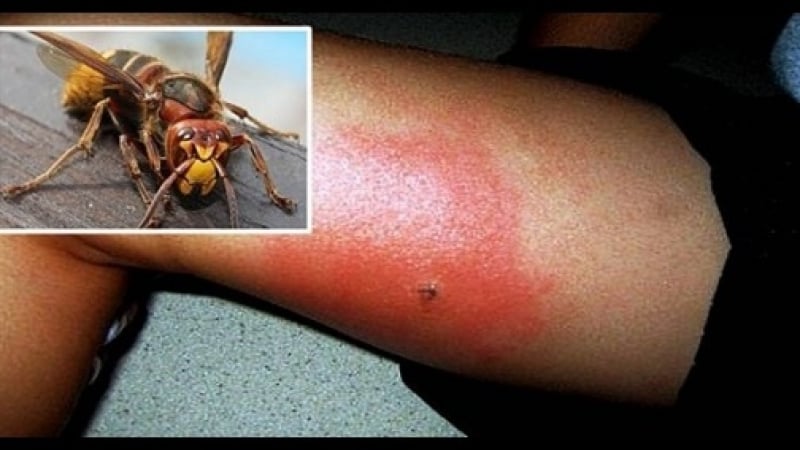Добре е да знаете: Ако Ви ужили оса, стършел или пчела - това ще Ви спести болката и подуването!