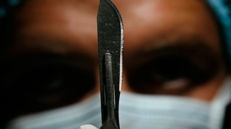 Самоук хирург едва не уби трансджендър по време на кастрация