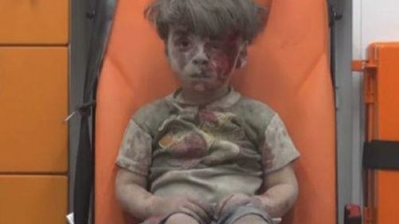 Спомняте ли си момченцето, което стана „символ на страданието в Алепо”? Ето какво се случва с малкия Омран днес (СНИМКИ)