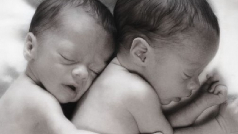 Тези близначета щяха да издъхнат, но това, което се случи, промени изцяло медицината!   