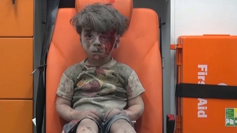 Бащата на сирийчето, станало символ на страданията на Алепо, доказа лъжите на западните медии, използвали сина му за политически игри