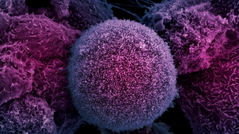 Учени показаха как раковите клетки се разпространяват в тялото в уникално ВИДЕО с движението на метастазите 