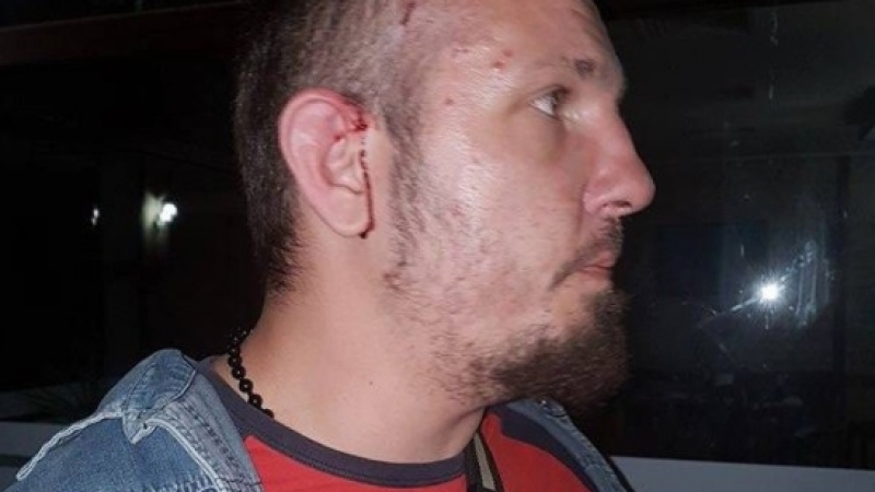 Рапърът Ицака МС е бил пребит от тумбата роми, предвождана от Кальо Тарзана