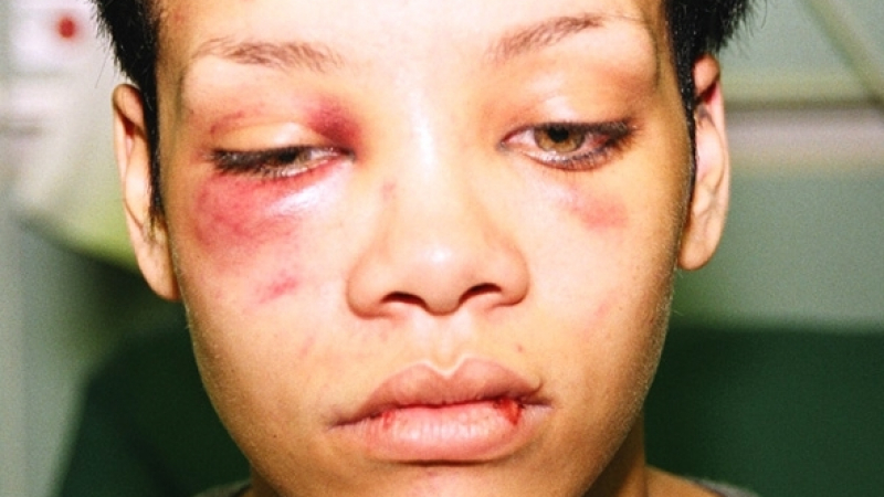 Крис Браун разкри нечувани досега подробности за побоя над Риана: Тя ме плюеше с кръв и ме удряше злобно!