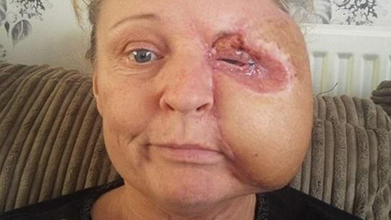 Майка се удари в печка и изгуби половината от лицето си заради нещо страшно (СНИМКИ)