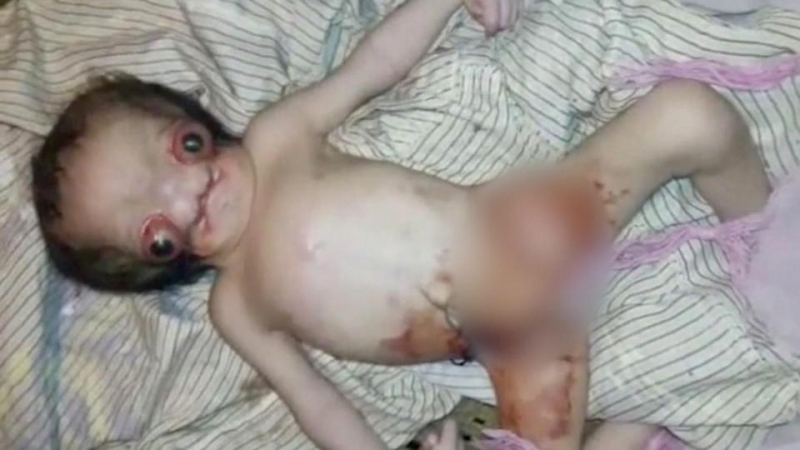 Жена роди в дома си, но съседи видяха бебето и се втрещиха: Извънземно е! Шокиращи СНИМКИ (18+)