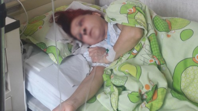 От "Пирогов" съобщиха какво се случва със сестра Стефанова, която бе пребита брутално от пациент