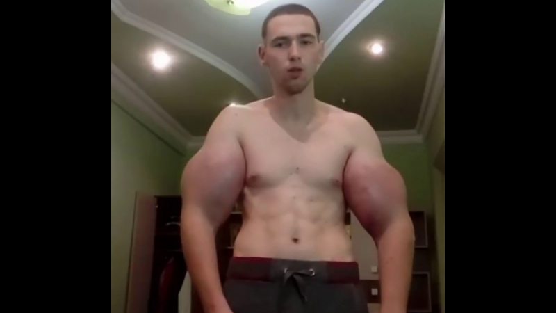 Руски влогър изду чудовищни мускули с отровни инжекции, но после... (ВИДЕО) 