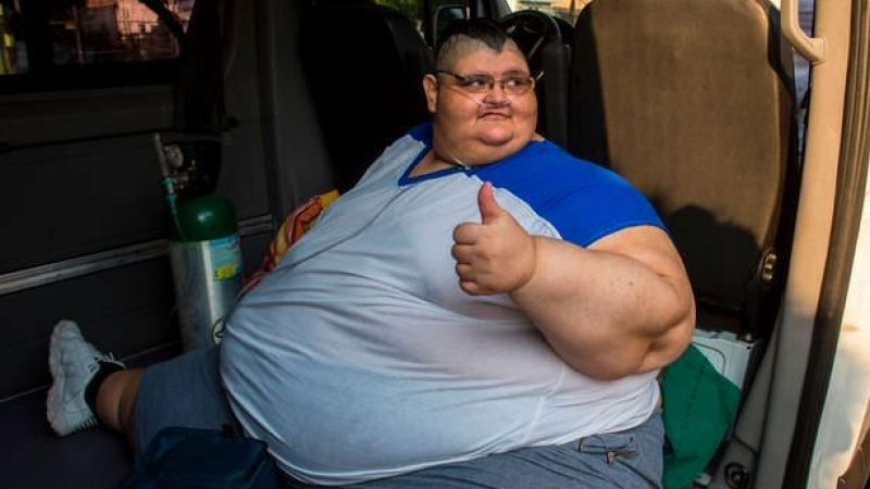 Най-дебелият човек в света свали 175 килограма, за да може лекарите да достигнат до стомаха му 