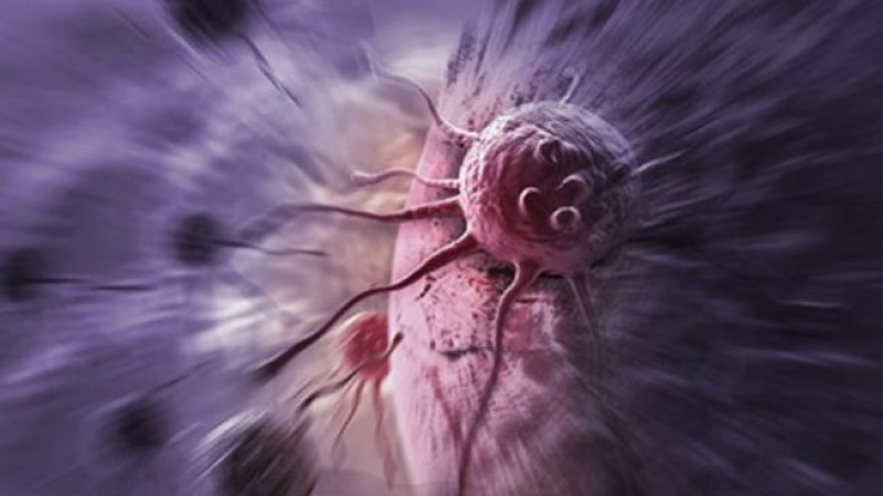 US-онколози назоваха 8 главни фактора за рак