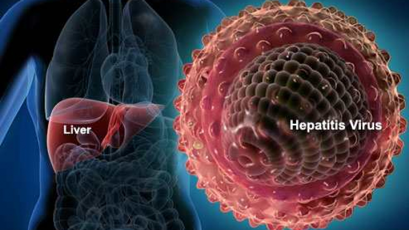 Доц. Йордан Генов разказва какви са симптомите на хепатит С и как се лекува